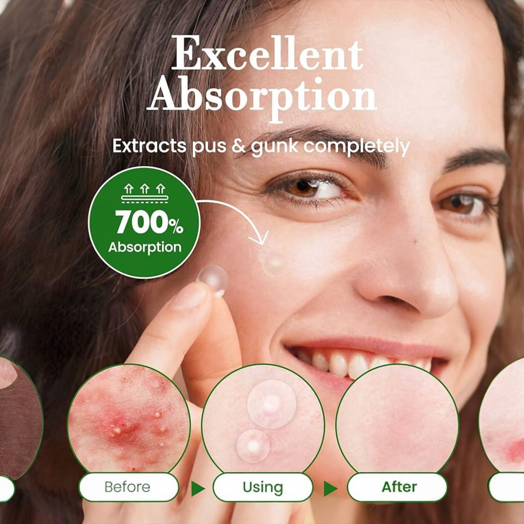 Parches Invisibles Anti-Acné The Signature con Hidrocoloide de Alta Calidad Invisible+ Spot Patch TROUBLESS - 96 Parches